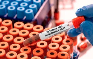 Diphtheria outbreak in Plateau State records 23 deaths and 143 suspected cases