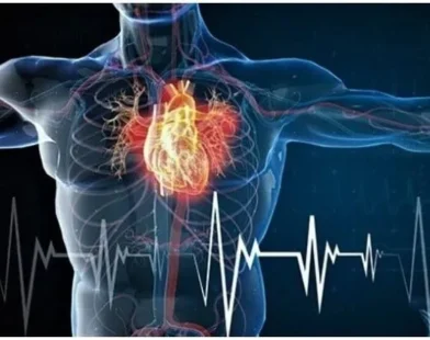 Medical illustration showing cholesterol plaque narrowing an artery and restricting blood flow
