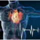 Medical illustration showing cholesterol plaque narrowing an artery and restricting blood flow
